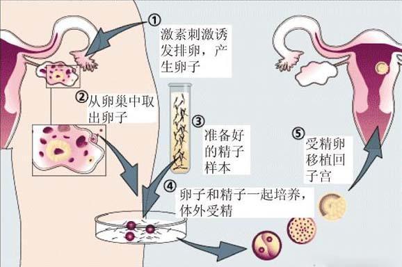 供卵流程是怎样的(供卵流程解析：详细了解供卵流程是怎样的)