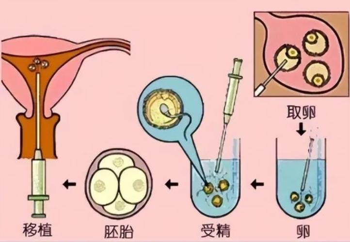 供卵的孩子和母亲长得像吗_供卵孩子与母亲长相相似度调查
